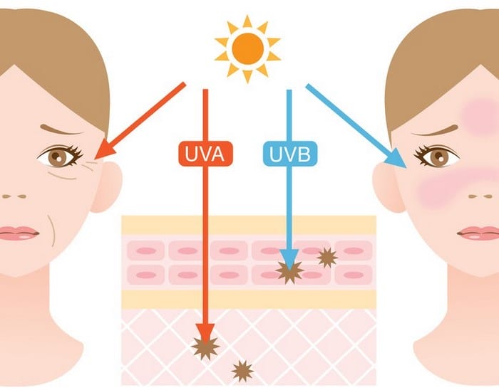 Loại bức xạ nào từ mặt trời gây ra hiện tượng rám nắng chính là tia UVA